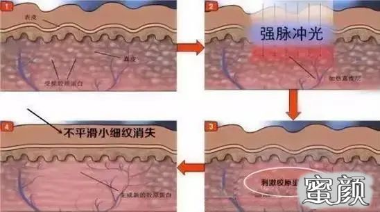 案例图片