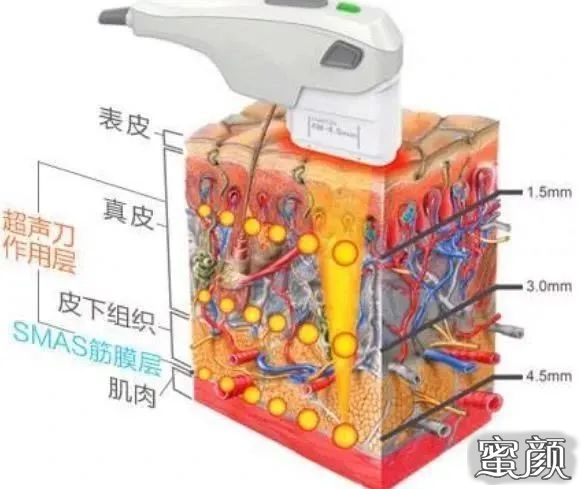 案例图片