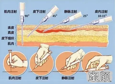 案例图片