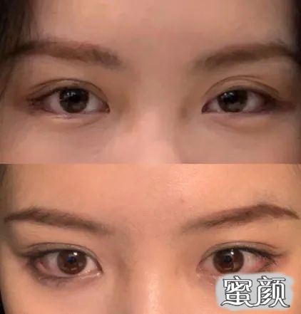 https://img.yiyiaimei.com/mnt/timg/201206/2314295924-3.jpg