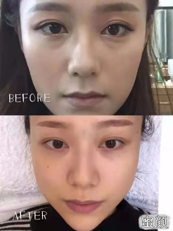 https://img.yiyiaimei.com/mnt/timg/201206/2315325b9-7.jpg