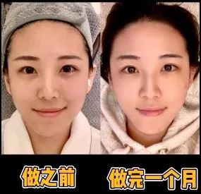 https://img.yiyiaimei.com/mnt/timg/201206/2315332D0-9.jpg