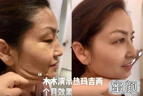 https://img.yiyiaimei.com/mnt/timg/201206/2315343K4-10.jpg