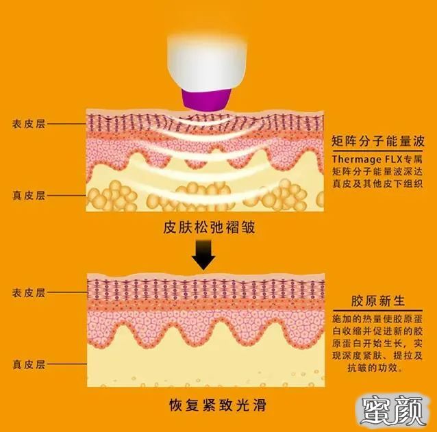 https://img.yiyiaimei.com/mnt/timg/201207/1UT56209-0.jpg