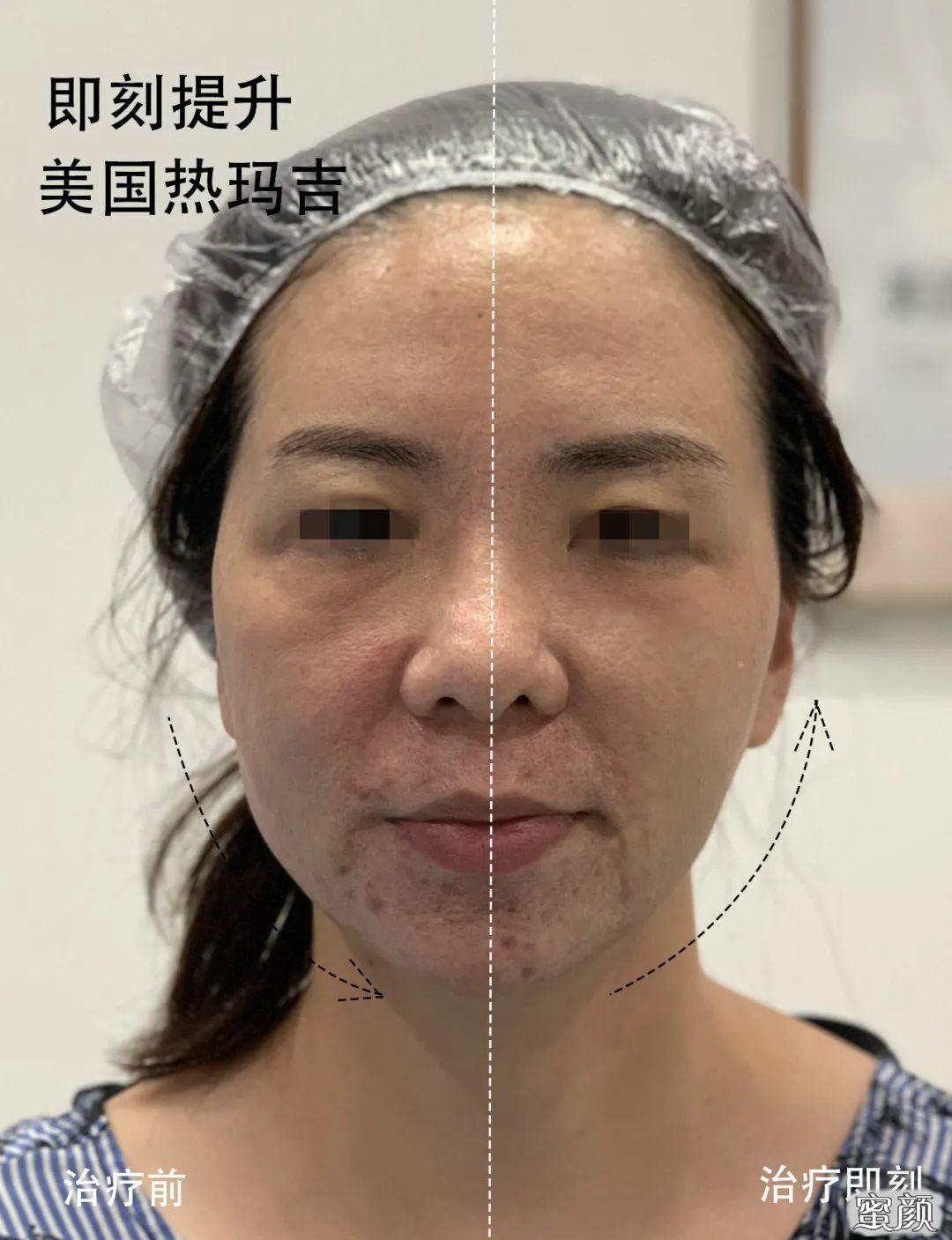 https://img.yiyiaimei.com/mnt/timg/201207/1UT913E-5.jpg