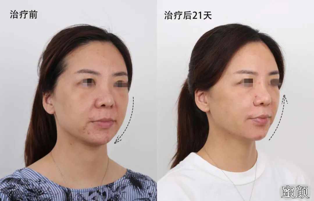 https://img.yiyiaimei.com/mnt/timg/201207/1UU04G0-6.jpg