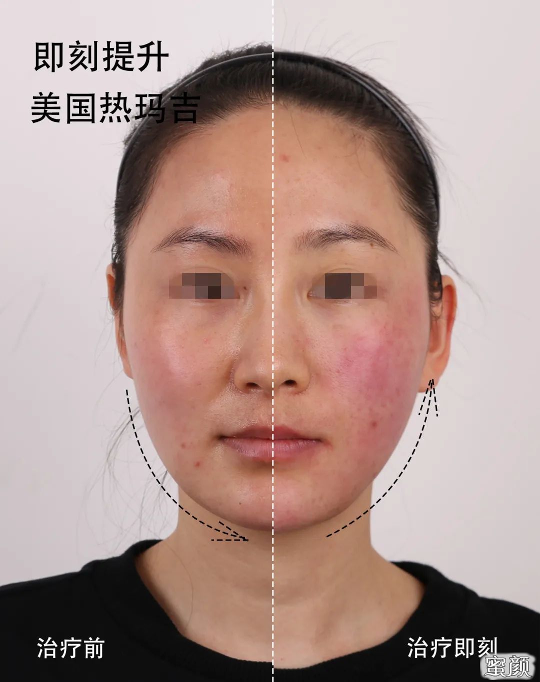 https://img.yiyiaimei.com/mnt/timg/201207/1UU1F01-7.jpg