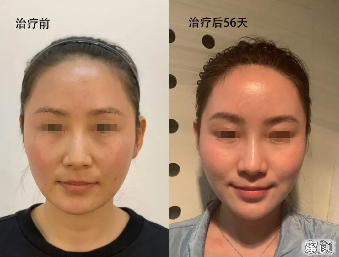 https://img.yiyiaimei.com/mnt/timg/201207/1UU260T-8.jpg