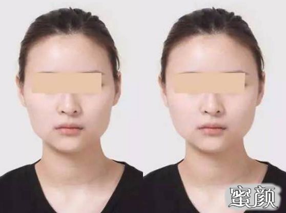 案例图片