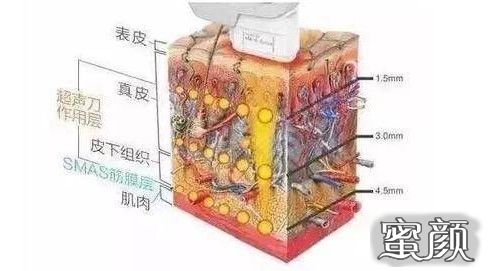 案例图片