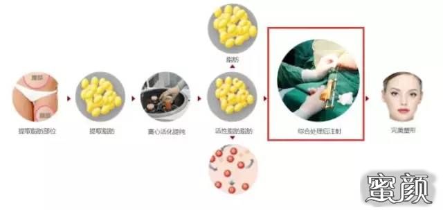 https://img.yiyiaimei.com/mnt/timg/201210/22122LS9-2.jpg