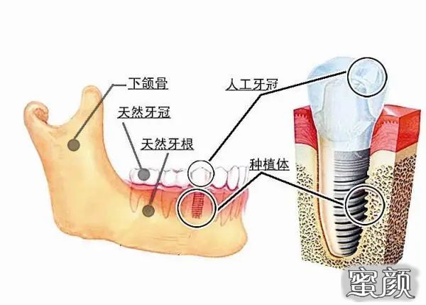 案例图片