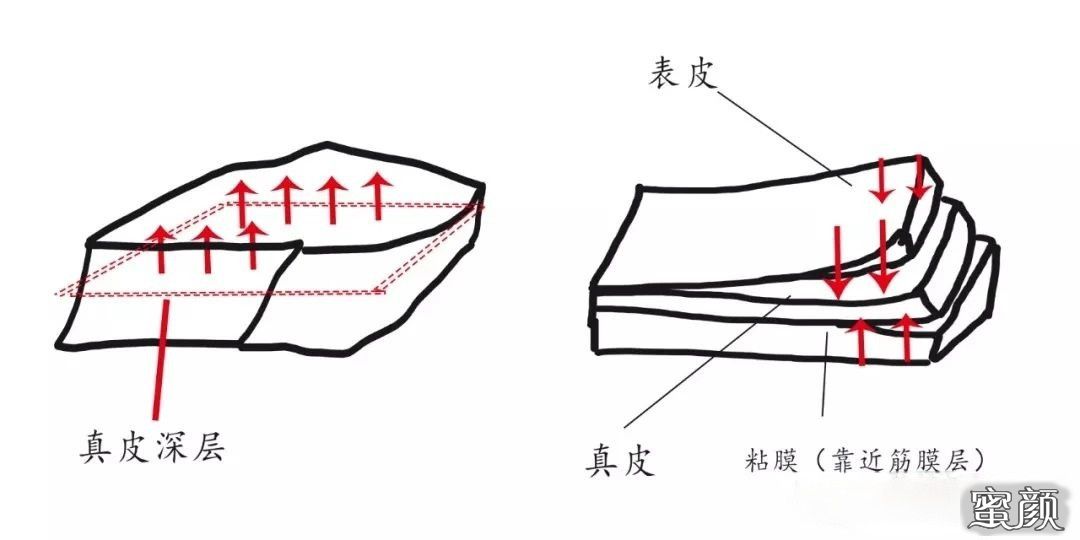 案例图片