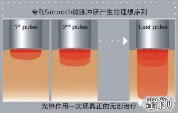 案例图片