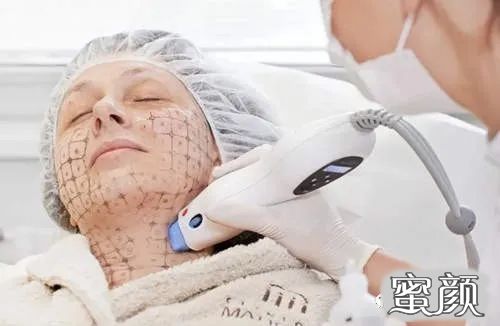 https://img.yiyiaimei.com/mnt/timg/201213/0K020GX-0.jpg 案例图片