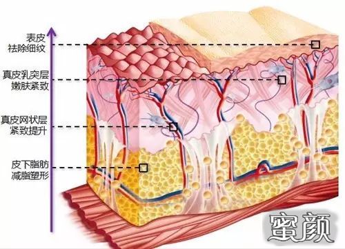 案例图片