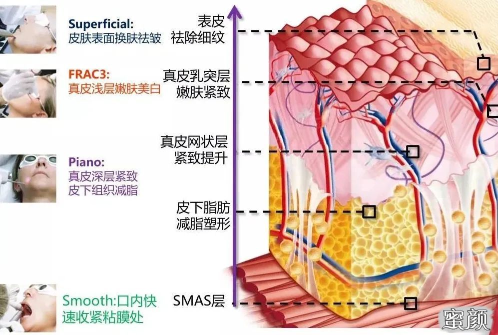 案例图片