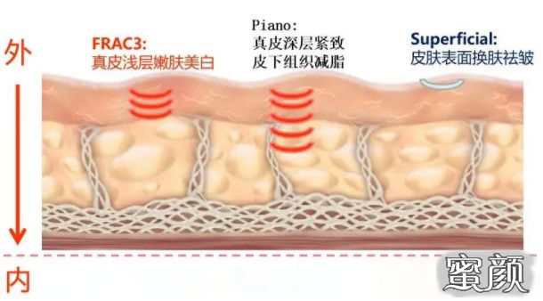 案例图片