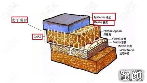 案例图片