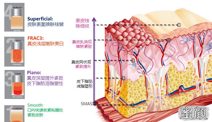 案例图片