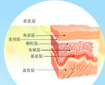 案例图片