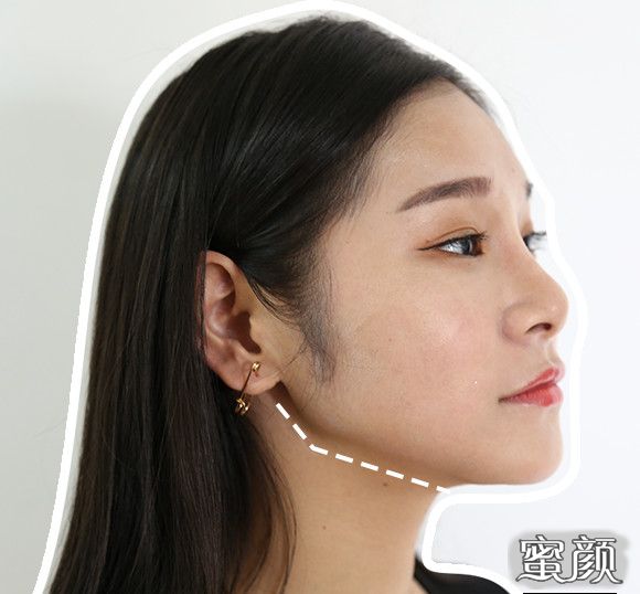 案例图片