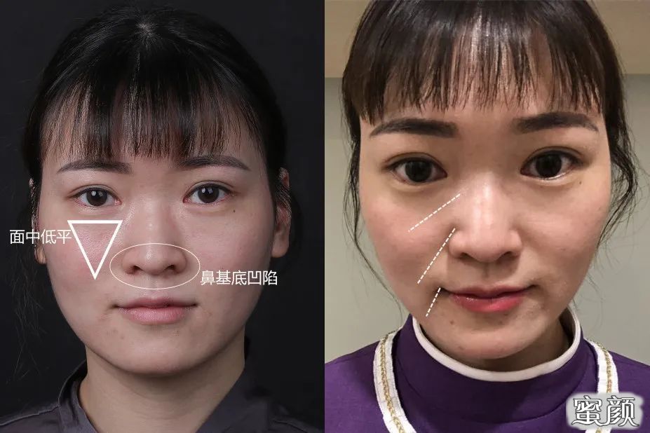 案例图片