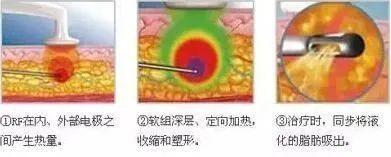 案例图片