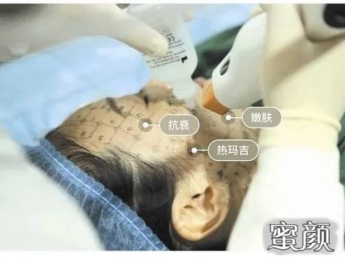 https://img.yiyiaimei.com/mnt/timg/201216/2050561B1-0.jpg