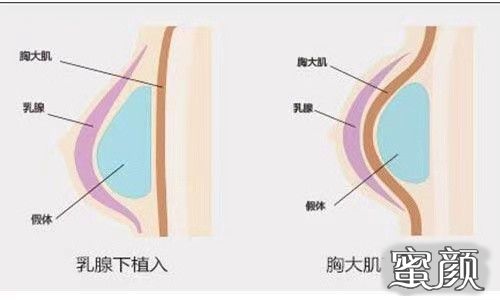 案例图片