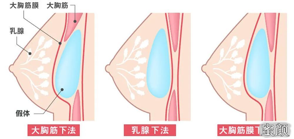 案例图片