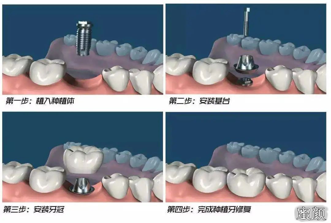 案例图片