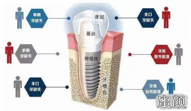 案例图片