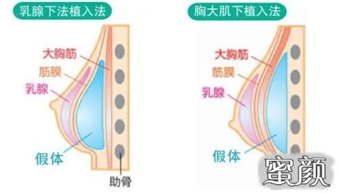 案例图片