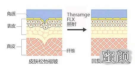 https://img.yiyiaimei.com/mnt/timg/201218/0U40R4Q-8.jpg