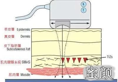 https://img.yiyiaimei.com/mnt/timg/201218/0U40T337-9.jpg