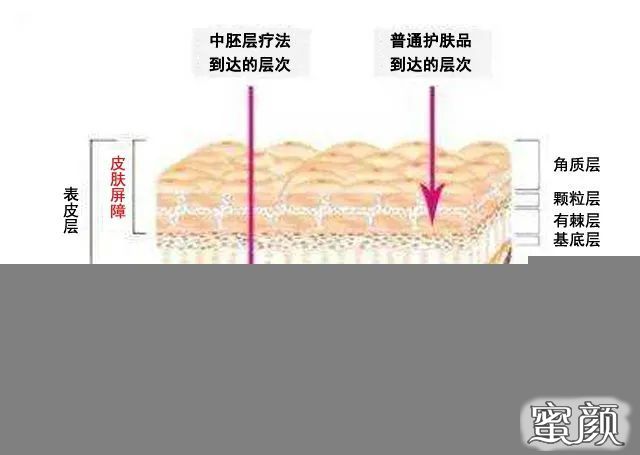 案例图片