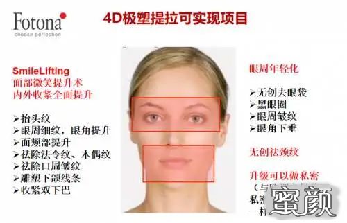 案例图片