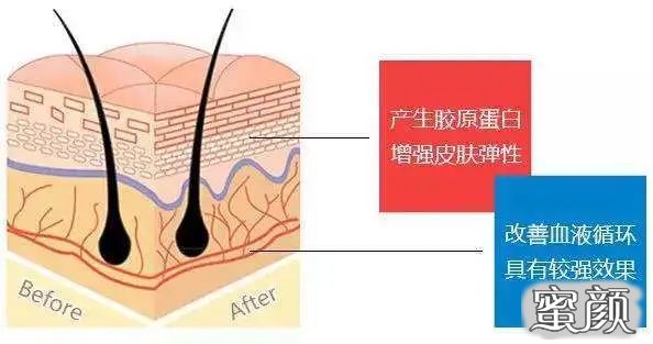 案例图片