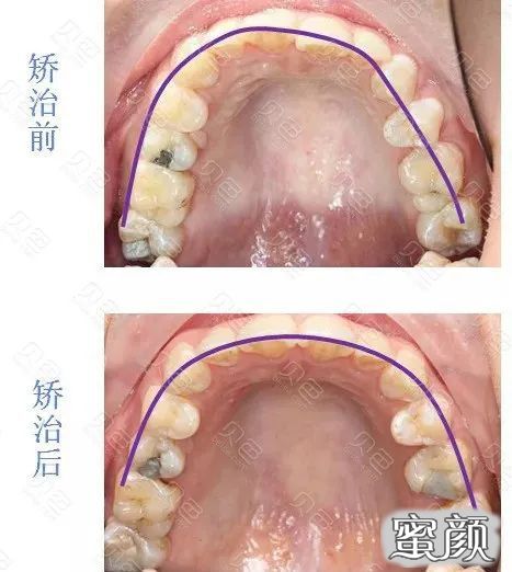 https://img.yiyiaimei.com/mnt/timg/201220/14433I196-3.jpg
