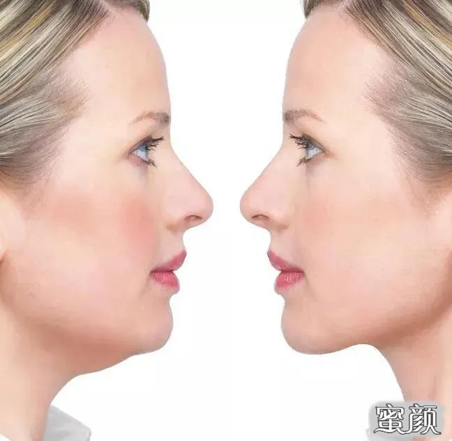 https://img.yiyiaimei.com/mnt/timg/201220/163530HU-1.jpg