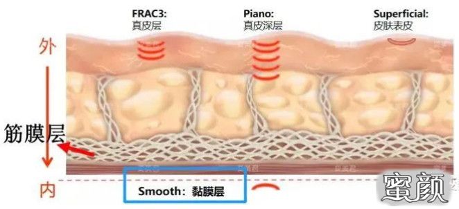 案例图片