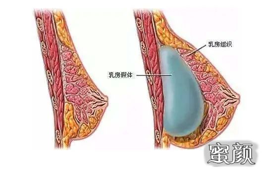 案例图片