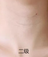 案例图片