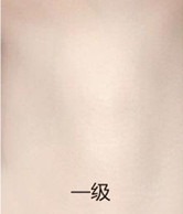 案例图片