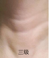 案例图片