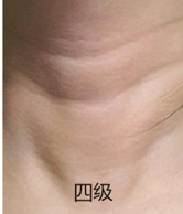 案例图片