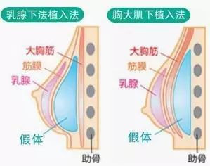 案例图片