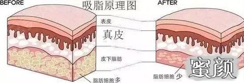 案例图片