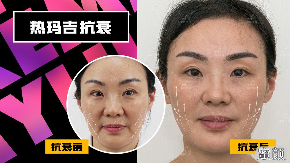 https://img.yiyiaimei.com/mnt/timg/201223/14441250c-3.jpg